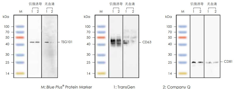 外泌體標志性蛋白檢測 外泌體標志性蛋白檢測