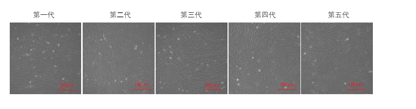 間充質(zhì)干細(xì)胞培養(yǎng)圖 間充質(zhì)干細(xì)胞培養(yǎng)圖